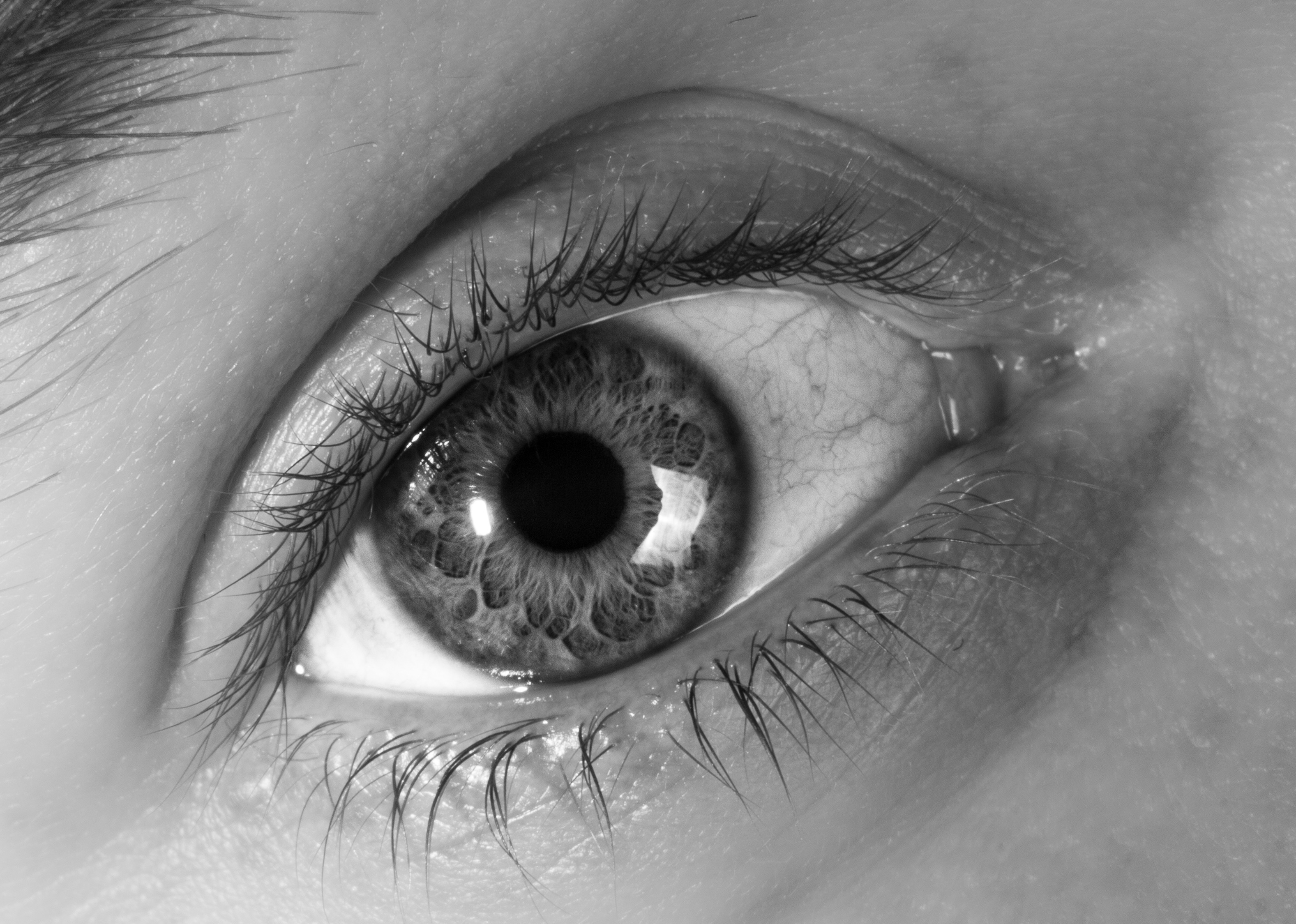 Eyelid Lift