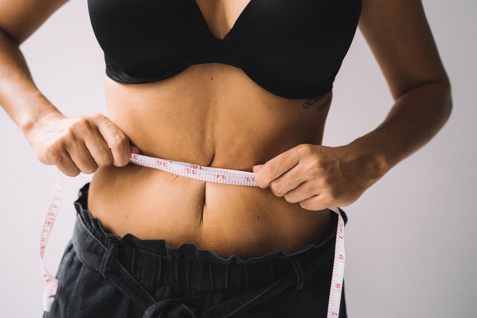 Liposuction